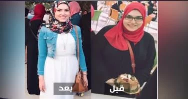 شاهدي كيف فقدت أسماء 50 كيلو من وزنها دون عمليات جراحية