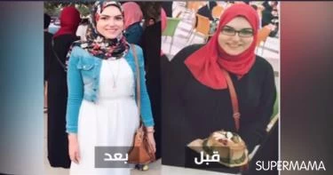 شاهدي كيف فقدت أسماء 50 كيلو من وزنها دون عمليات جراحية