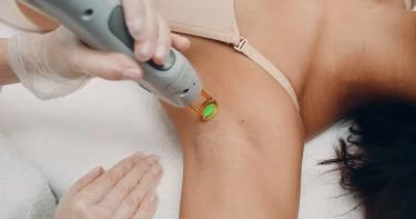 تفتيح المناطق الحساسة بالليزر