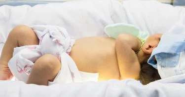 علاج الصفراء عند حديثي الولادة