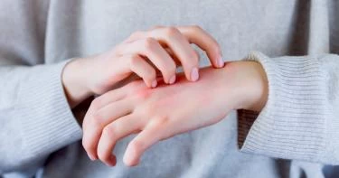 أعراض أمراض الكبد الأولية