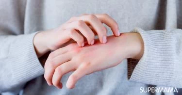 أعراض أمراض الكبد الأولية