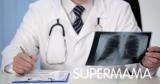تشخيص سرطان الرئة