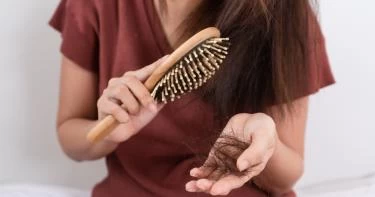 علاج تساقط الشعر بالثوم