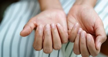 سبب تشقق الأظافر