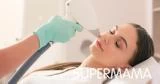 إزالة شعر الوجه بالليزر