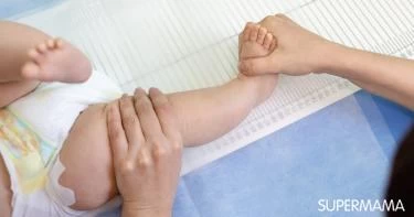 درجات خلع الورك