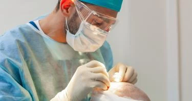 زراعة الشعر في السعودية