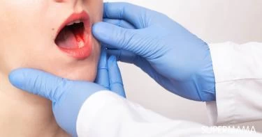 أعراض سرطان اللثة