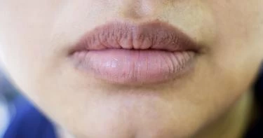 أسباب سواد الشفايف