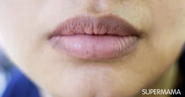 أسباب سواد الشفايف