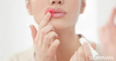 أمراض تظهر على الشفاه