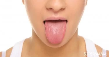أعراض إذا ظهرت على لسانك تدل على إصابتك بالأمراض