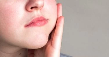 أسباب انتفاخ الخد