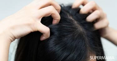 أسباب حكة فروة الرأس