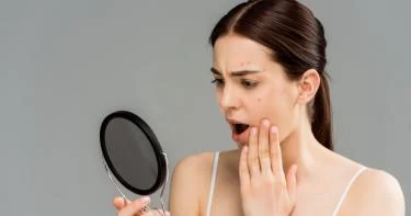 أسباب ظهور الحبوب في الوجه بعد الثلاثين