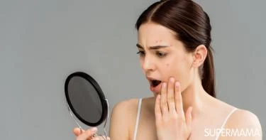 أسباب ظهور الحبوب في الوجه بعد الثلاثين