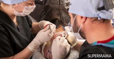 زراعة الشعر في الكويت