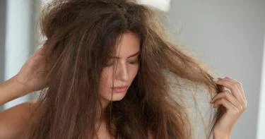 علاج تقصف الشعر من الأمام