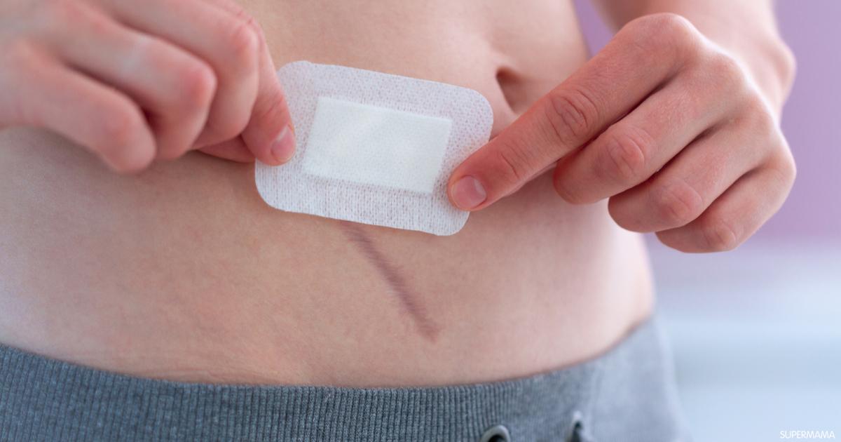 كم تستغرق مدة التئام الجرح بعد العملية الجراحية؟ | سوبر ماما