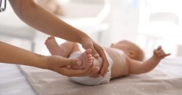 التواء القدم عند الأطفال حديثي الولادة