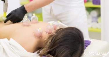 علاج الشقيقة بالحجامة