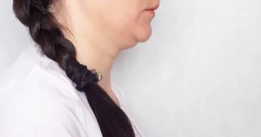 التخلص من دهون الرقبة