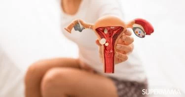 هل يمكن علاج تكيس المبايض بالأعشاب
