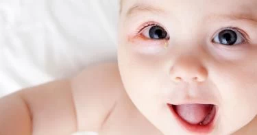 أسباب احمرار عين الرضيع