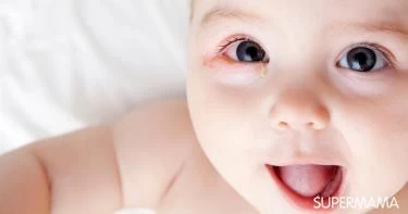 أسباب احمرار عين الرضيع