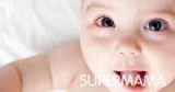 ما أسباب احمرار عين الرضيع؟