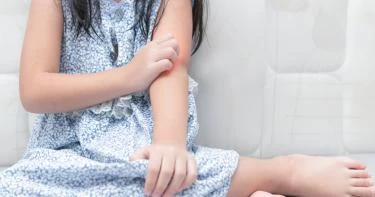 حساسية الفول السوداني عند الأطفال
