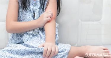 حساسية الفول السوداني عند الأطفال