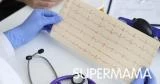 ما أنواع تخطيط القلب؟