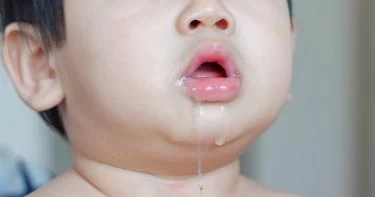 كثرة اللعاب عند الأطفال ثلاث سنوات