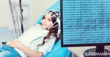 تخطيط الاعصاب للاطفال
