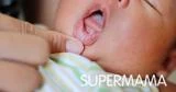 هل يمكن علاج فطريات الفم عند الرضع بالأعشاب؟