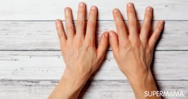 هل بروز عروق اليد من علامات الحمل؟