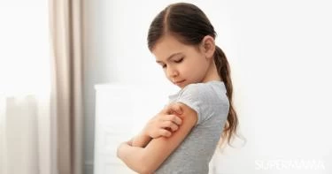 أعراض حساسية السمك عند الأطفال