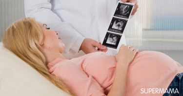 شكل الجنين في الأسبوع الثامن بالسونار