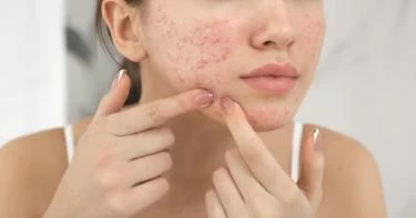 أعراض ارتفاع هرمون الغدة الكظرية