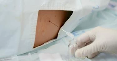 ما دواعي إجراء تحليل النخاع الشوكي للأطفال