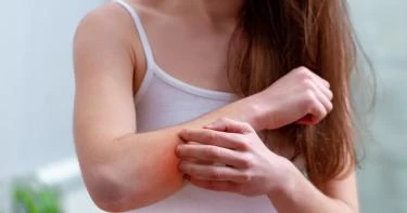 هل يمكن علاج حساسية الجلد بالعسل