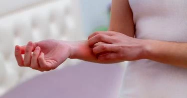 أسباب حساسية الدم