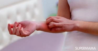 أسباب حساسية الدم