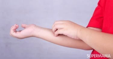أعراض الجرب عند الأطفال