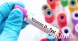 معلومات هامة عن تحليل فيتامين د