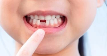 متى تظهر الأسنان الدائمة؟