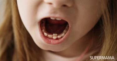 أسنان القرش عند الأطفال: ما المقصود بها؟