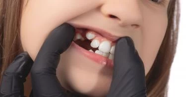 ظهور الأنياب عند الأطفال